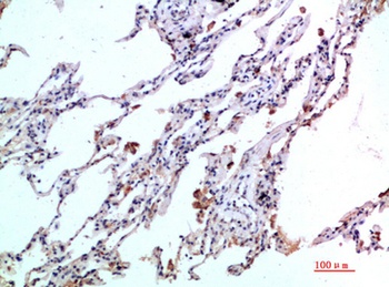 Eotaxin-2 rabbit pAb Antibody