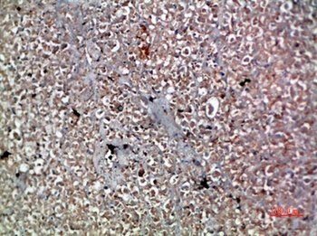 IL-20 rabbit pAb Antibody