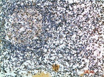 6CKine rabbit pAb Antibody