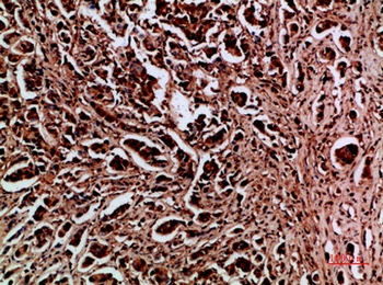 HDGF rabbit pAb Antibody