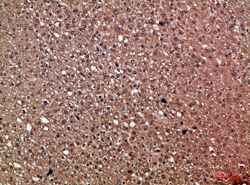 HDGF rabbit pAb Antibody