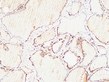 Thyroglobulin rabbit pAb Antibody