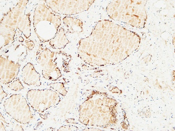 Thyroglobulin rabbit pAb Antibody