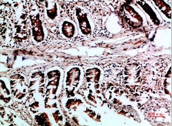 VHL rabbit pAb Antibody