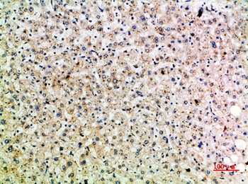 HSP 75 rabbit pAb Antibody