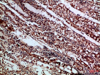 CD66a/b/c rabbit pAb Antibody