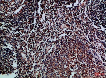 CD70 rabbit pAb Antibody