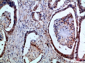 FAS-L rabbit pAb Antibody