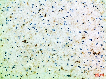 Frizzled-4 rabbit pAb Antibody