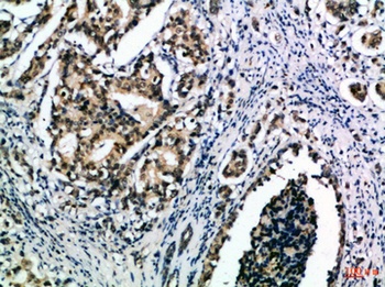 IL-15 rabbit pAb Antibody