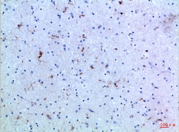 IL-15 rabbit pAb Antibody