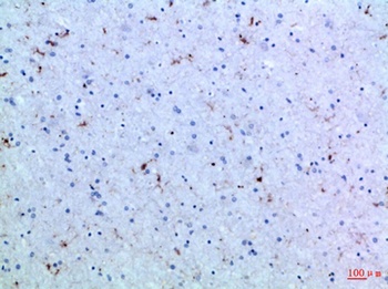 IL-15 rabbit pAb Antibody