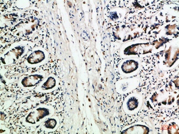 MCP-3 rabbit pAb Antibody