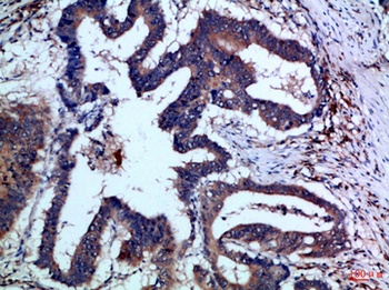 IL-17F rabbit pAb Antibody