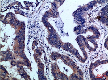 IL-17F rabbit pAb Antibody