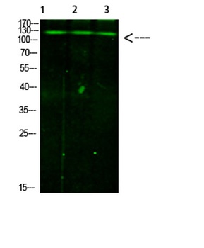 JAK2/3 (Phospho-Tyr966/939) Rabbit pAb Antibody