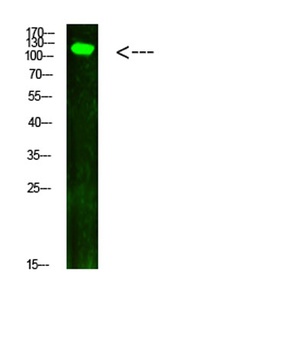 JAK2/3 (Phospho-Tyr966/939) Rabbit pAb Antibody