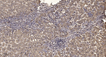 JAK2/3 (Phospho-Tyr966/939) Rabbit pAb Antibody