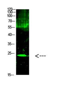 Cardiotrophin-1 rabbit pAb Antibody