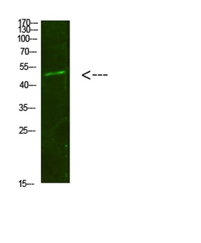 Smad1/5/9 rabbit pAb Antibody