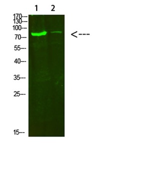 COL8A2 rabbit pAb Antibody