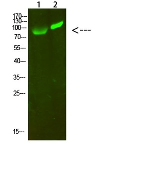 GCK/GLK rabbit pAb Antibody
