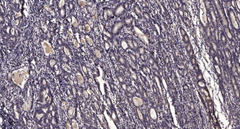 SYK (Phospho-Tyr348) Rabbit pAb Antibody