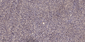 Smad3 (Phospho-Ser213) Rabbit pAb Antibody