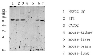 RIPK2 (Phospho-Ser176) Antibody