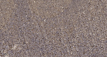 RIPK2 (Phospho-Ser176) Antibody