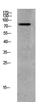 GRK2 (Phospho-Ser685) Rabbit pAb Antibody