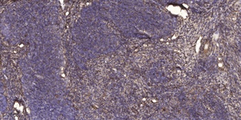 Na+/K+-ATPase α1 (Phospho-Tyr260) rabbit pAb Antibody