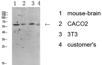 Tyrosine Hydroxylase rabbit pAb Antibody