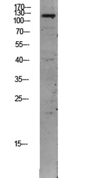 TIE2 rabbit pAb Antibody