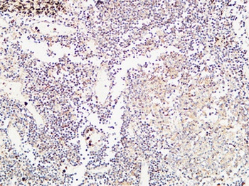 TIE2 rabbit pAb Antibody
