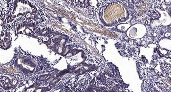 Keratin 8 rabbit pAb Antibody