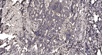 LATS1/2 Rabbit pAb Antibody