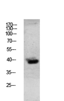 Granzyme B rabbit pAb Antibody