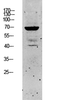 Keratin 5 rabbit pAb Antibody