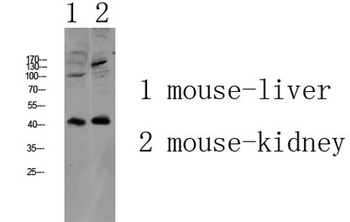 AGTR1 rabbit pAb Antibody