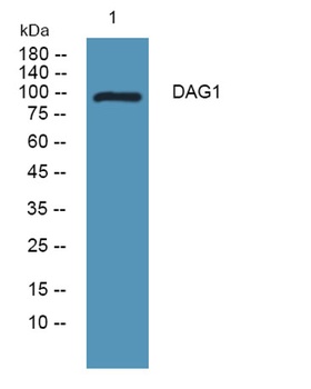 DAG1 rabbit pAb Antibody