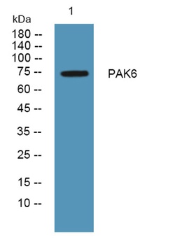 PAK6 rabbit pAb Antibody