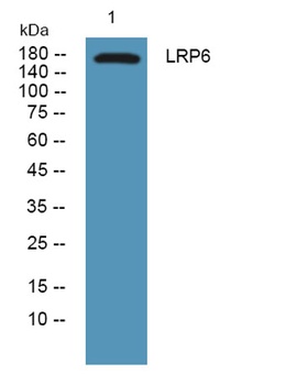 LRP6 rabbit pAb Antibody