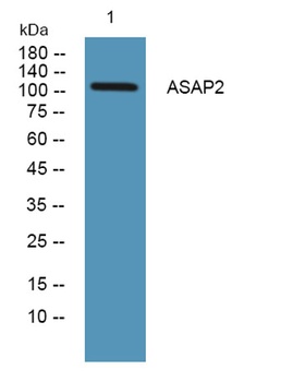 ASAP2 rabbit pAb Antibody