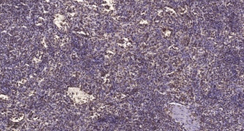 CHD8 rabbit pAb Antibody