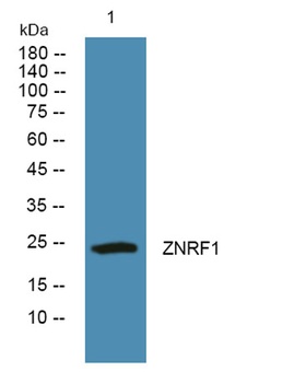 ZNRF1 rabbit pAb Antibody