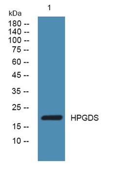 HPGDS rabbit pAb Antibody