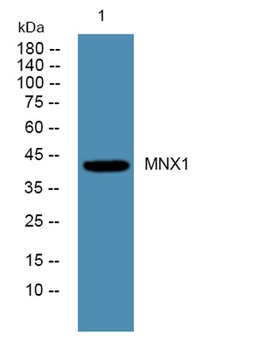 MNX1 rabbit pAb Antibody