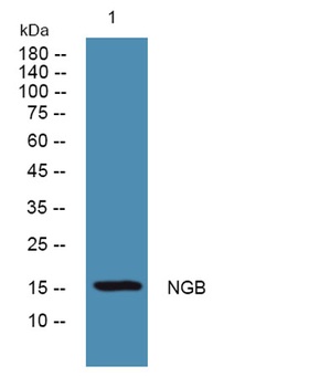 NGB rabbit pAb Antibody
