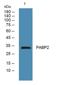 PABP2 rabbit pAb Antibody